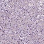 AADAT Antibody in Immunohistochemistry (Paraffin) (IHC (P))