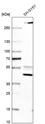 AADAT Antibody in Western Blot (WB)