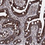HADHB Antibody in Immunohistochemistry (Paraffin) (IHC (P))