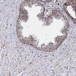 HADHB Antibody in Immunohistochemistry (Paraffin) (IHC (P))