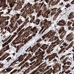 HADHB Polyclonal Antibody