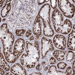HADHB Antibody in Immunohistochemistry (Paraffin) (IHC (P))