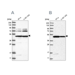 HADHB Antibody in Western Blot (WB)