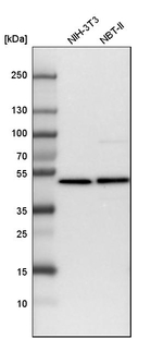 HADHB Antibody in Western Blot (WB)