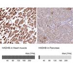 HADHB Antibody
