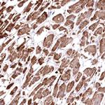 HADHB Antibody in Immunohistochemistry (Paraffin) (IHC (P))