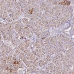 HADHB Antibody in Immunohistochemistry (Paraffin) (IHC (P))