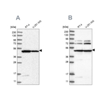 HADHB Antibody in Western Blot (WB)