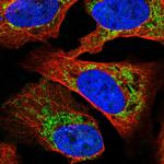 SLC16A12 Polyclonal Antibody