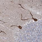 SHIP2 Antibody in Immunohistochemistry (Paraffin) (IHC (P))