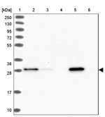 GST Omega 1 140A Antibody in Western Blot (WB)