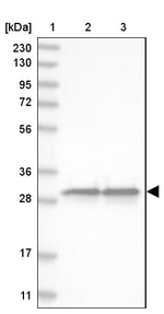 GST Omega 1 140A Antibody in Western Blot (WB)