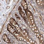 PIK3C2A Antibody in Immunohistochemistry (Paraffin) (IHC (P))
