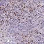 CD8 alpha Antibody in Immunohistochemistry (Paraffin) (IHC (P))