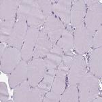 CD8 alpha Antibody in Immunohistochemistry (Paraffin) (IHC (P))