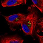 Arylsulfatase B Polyclonal Antibody