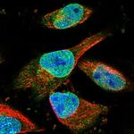 ZNF487 Polyclonal Antibody