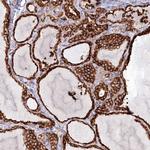 POGLUT1 Polyclonal Antibody