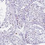SPATA16 Antibody in Immunohistochemistry (Paraffin) (IHC (P))