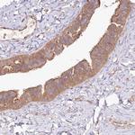 TNIP1 Antibody in Immunohistochemistry (Paraffin) (IHC (P))
