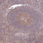 TNIP1 Antibody in Immunohistochemistry (Paraffin) (IHC (P))