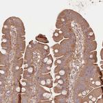 TNIP1 Antibody in Immunohistochemistry (Paraffin) (IHC (P))