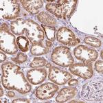 PRDX5 Antibody in Immunohistochemistry (Paraffin) (IHC (P))