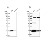 PRDX5 Antibody in Western Blot (WB)