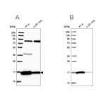 PRDX5 Antibody in Western Blot (WB)