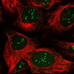 LPIN1 Polyclonal Antibody