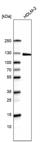 LPIN1 Antibody in Western Blot (WB)