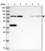 XPD Antibody in Western Blot (WB)