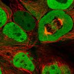 CAS Polyclonal Antibody