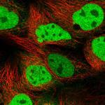 CAS Polyclonal Antibody