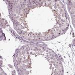 SPATA7 Antibody in Immunohistochemistry (Paraffin) (IHC (P))