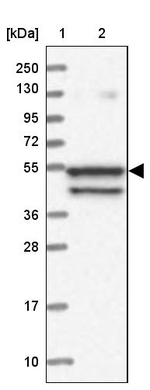 SPATA7 Antibody in Western Blot (WB)