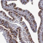 STING Antibody in Immunohistochemistry (Paraffin) (IHC (P))
