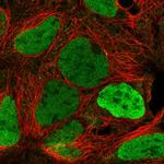 JARID1C Polyclonal Antibody