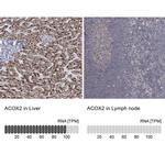 ACOX2 Antibody