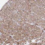 ACOX2 Antibody in Immunohistochemistry (Paraffin) (IHC (P))