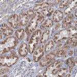 ACOX2 Antibody in Immunohistochemistry (Paraffin) (IHC (P))