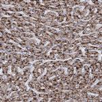 ACOX2 Antibody in Immunohistochemistry (Paraffin) (IHC (P))