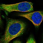 BHMT Polyclonal Antibody