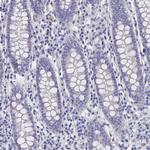 BHMT Antibody in Immunohistochemistry (Paraffin) (IHC (P))