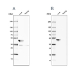 BHMT Antibody in Western Blot (WB)