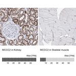 MCCC2 Antibody