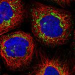 MCCC2 Polyclonal Antibody