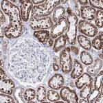 MCCC2 Antibody in Immunohistochemistry (Paraffin) (IHC (P))