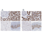 MCCC2 Antibody in Immunohistochemistry (Paraffin) (IHC (P))