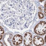 MCCC2 Antibody in Immunohistochemistry (Paraffin) (IHC (P))